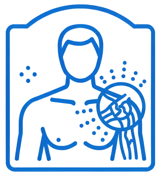 Akromiyoklaviküler (AC) Eklem Yaralanması
